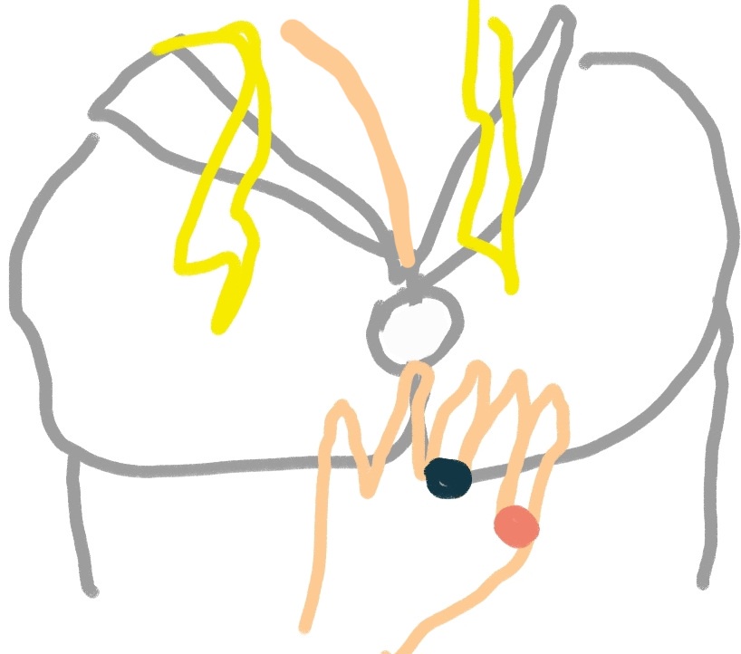 KxQ5hsE.jpeg